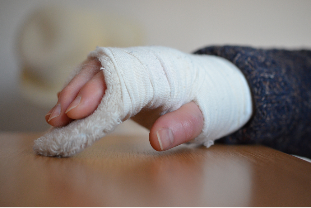 Knee Replacement Model