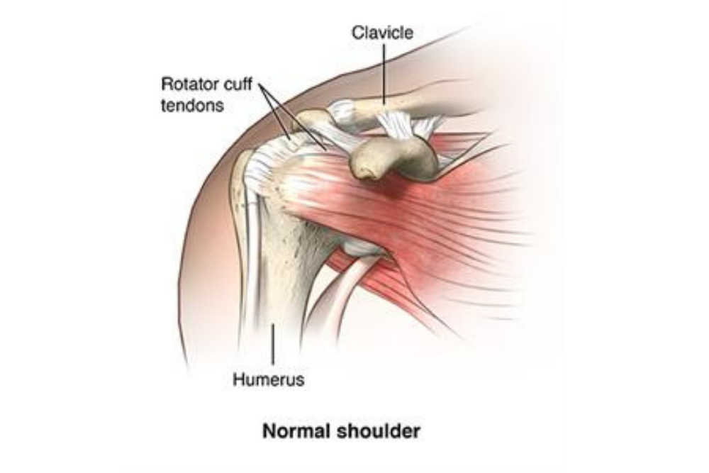 Knee Replacement Model