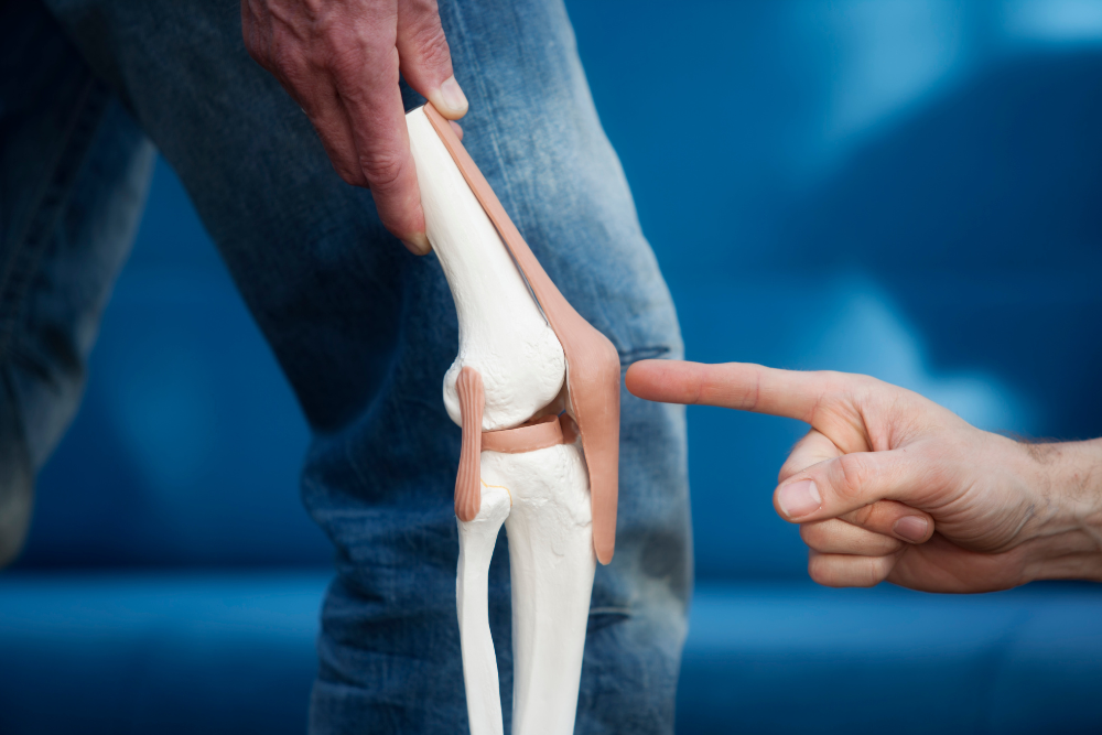 Knee Replacement Model
