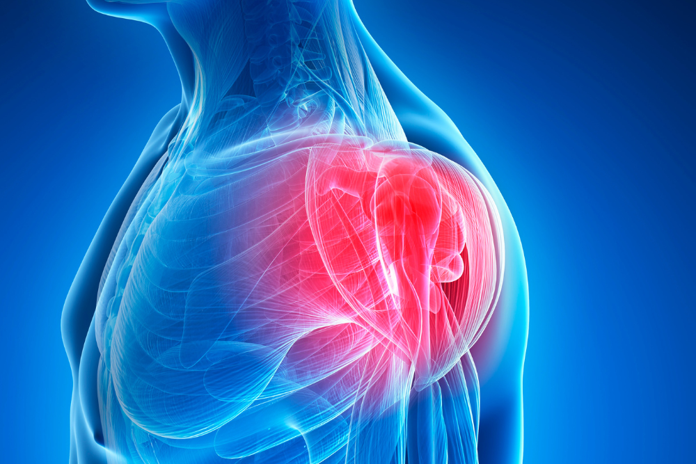 Knee Replacement Model